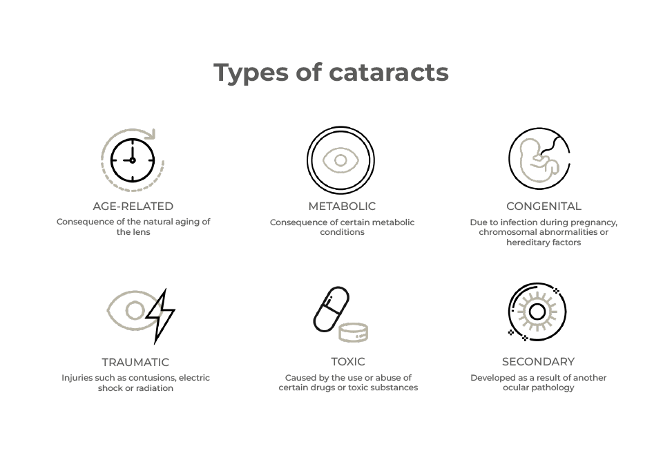 types of cataracts what does cataract surgery clinica rahhal