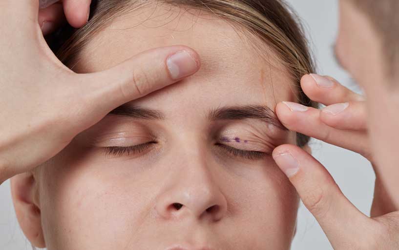 evaluacion inicial oculoplastia laser co2 periocular clinica oftalmologica rahhal valencia